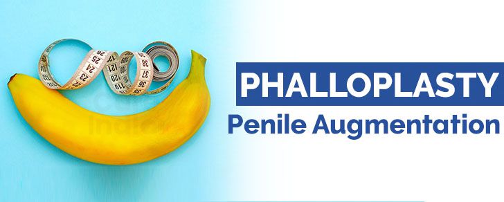 phalloplasty-penile-augmentation